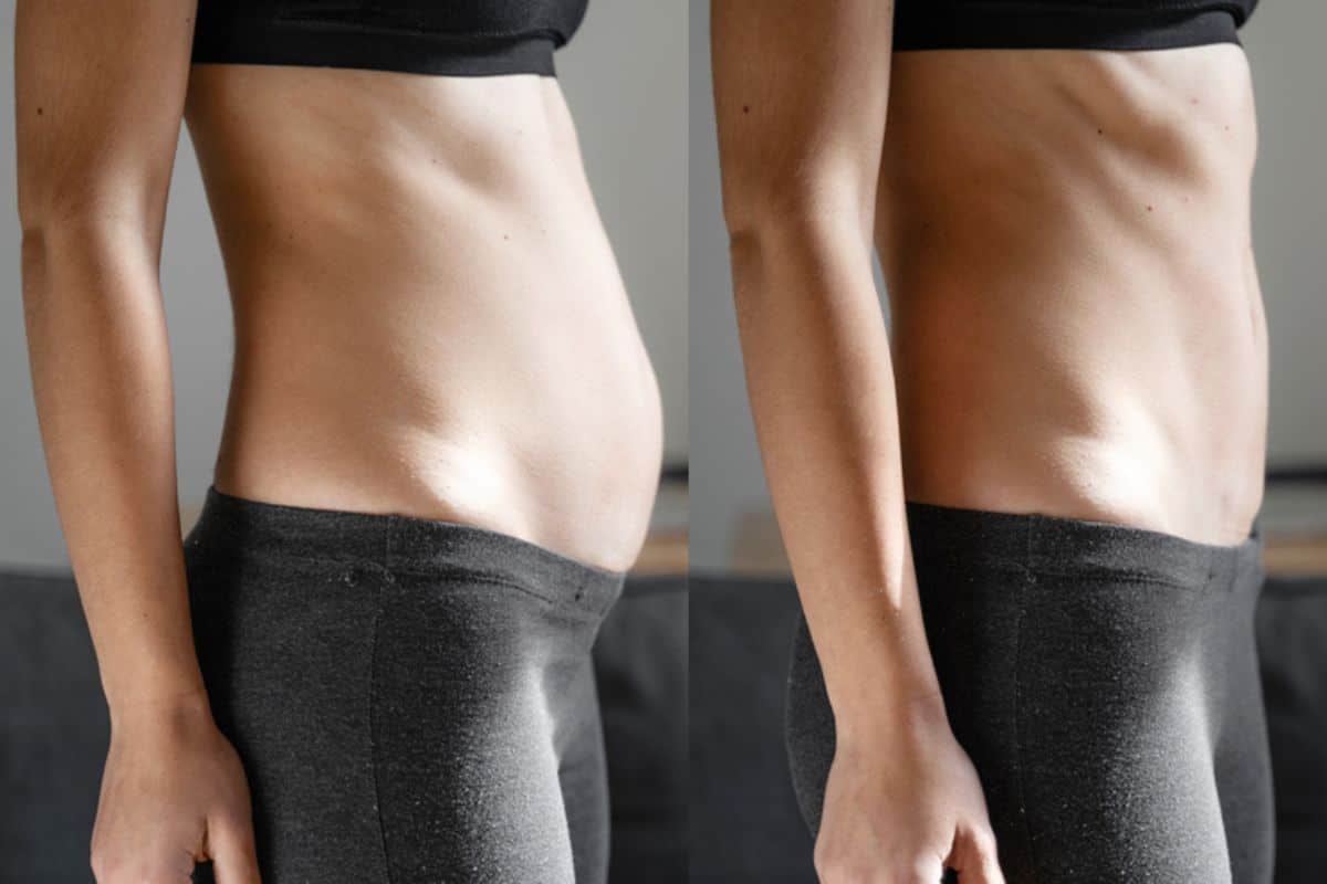 Post-Pregnancy: What Happens to Your Abdominal Muscles After Birth New Malden