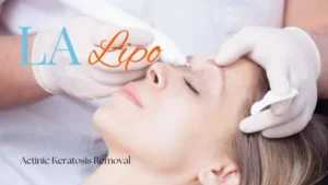 Woman receiving Actinic Keratosis Removal Treatment New Malden