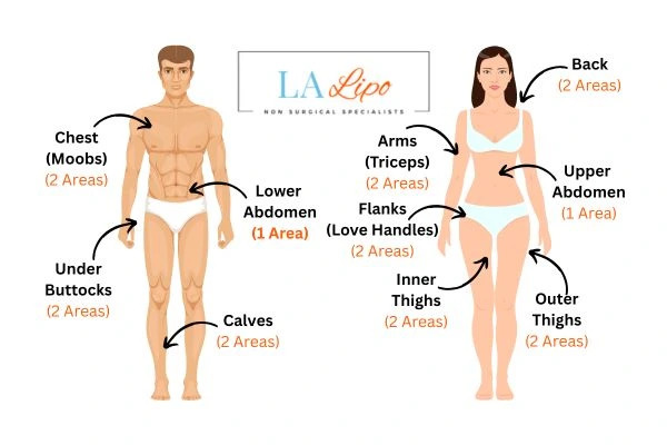 LA LIPO Cryolipolysis Areas New Malden