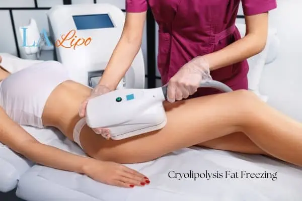 Woman receiving coolsculpting New Malden treatment on her thighs