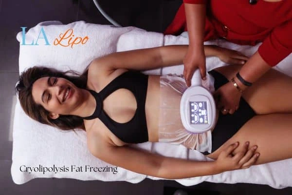 woman getting cryolipolysis New Malden