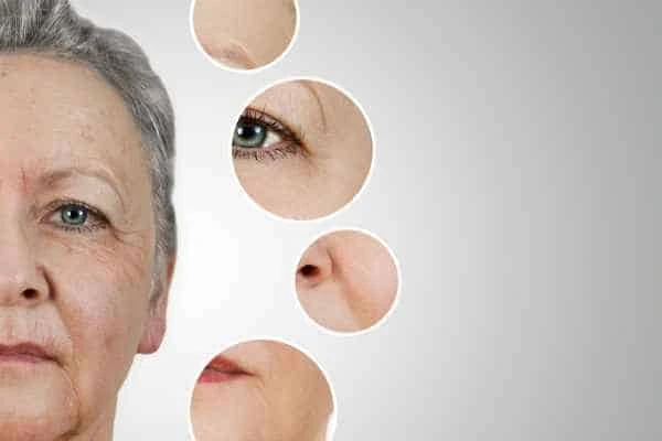 HIFU Facelift New Malden from LA LIPO