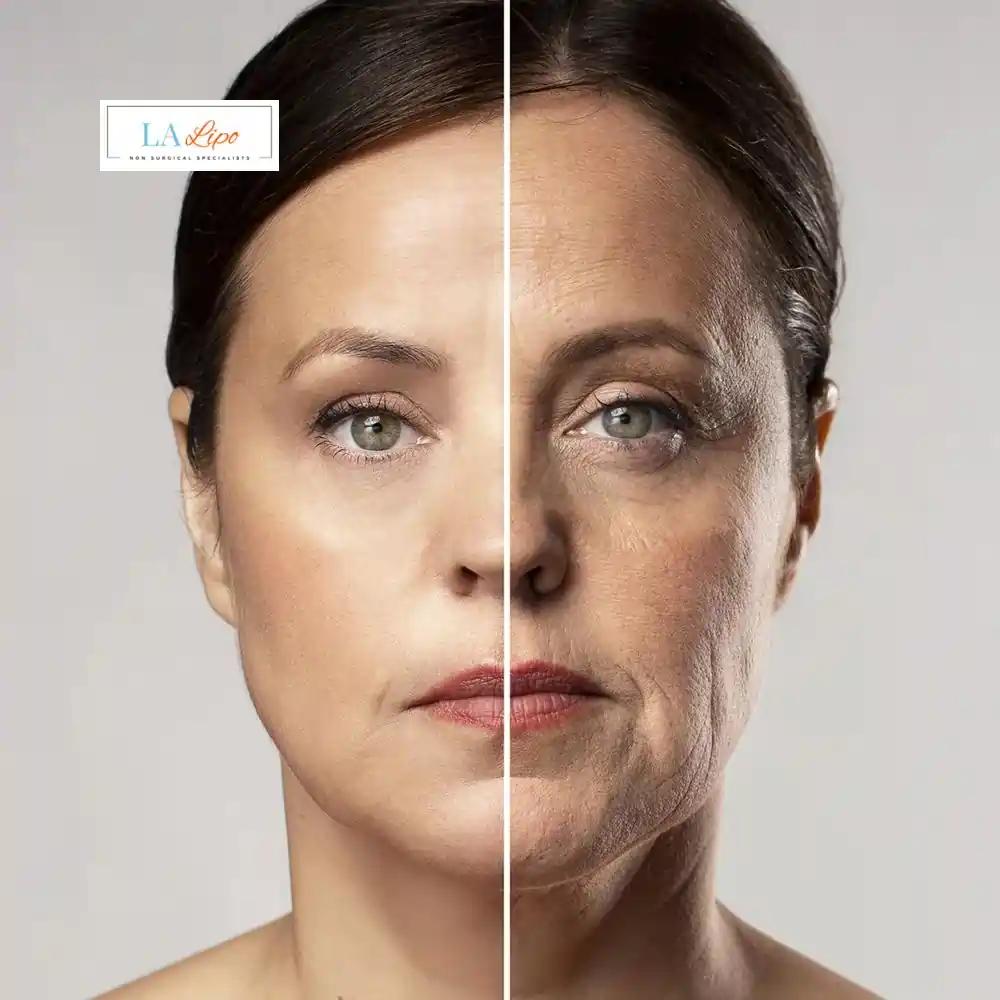 How Can You Tell If Non-Surgical Skin Tightening Is Right for You New Malden?