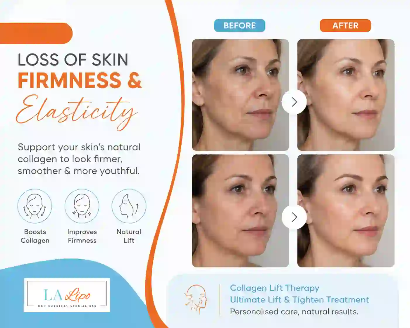 Sign #7: Loss of Skin Firmness and Elasticity New Malden